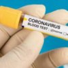 Хворій з Борзнянського району підтверджено діагноз COVID-19