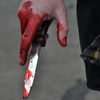 Поліція оперативно затримала зловмисника, який в ході бійки завдав ножових поранень трьом чоловікам